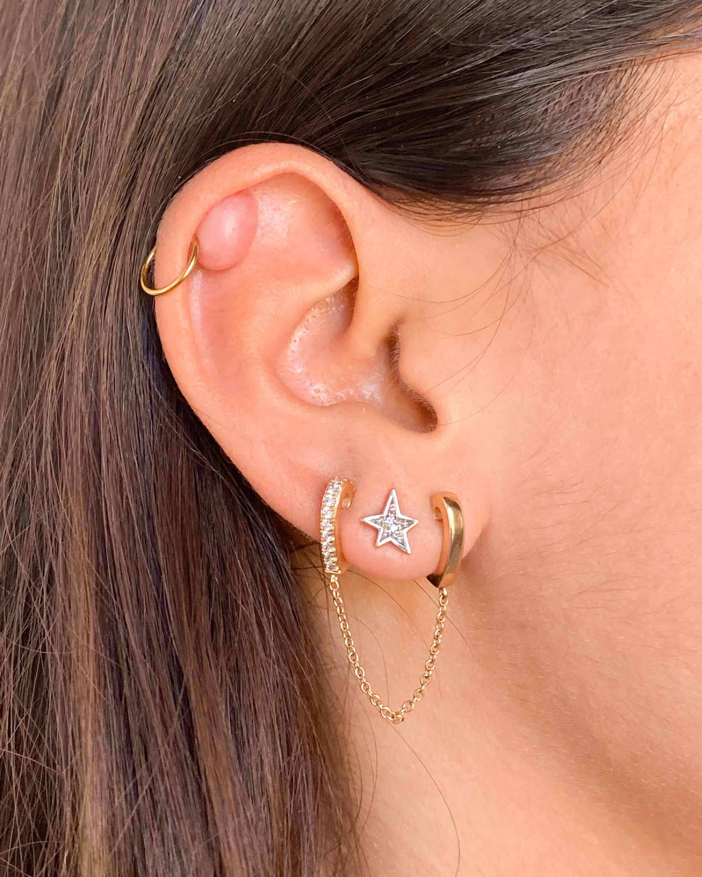 Chéloïde piercing - exemple